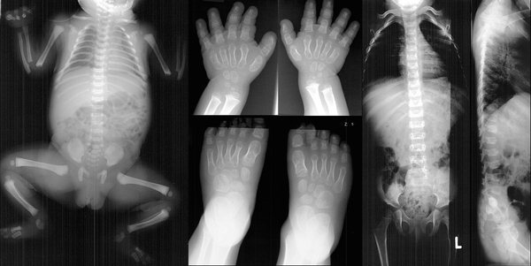 © Institut für Diagnostische, Interventionelle und Pädiatrische