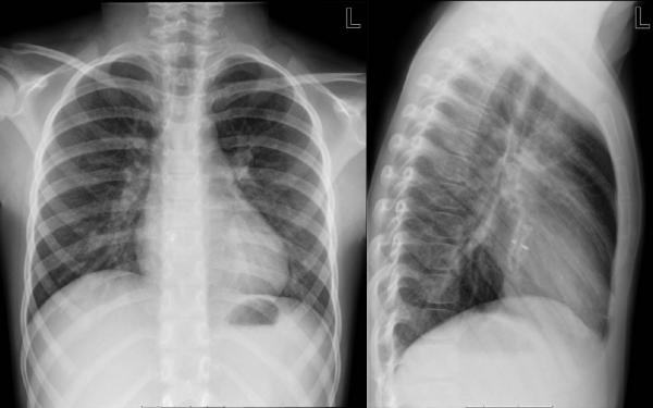 © Institut für Diagnostische, Interventionelle und Pädiatrische ...