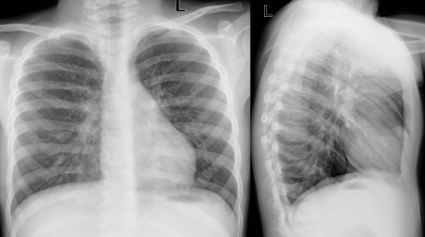 © Institut für Diagnostische, Interventionelle und Pädiatrische ...