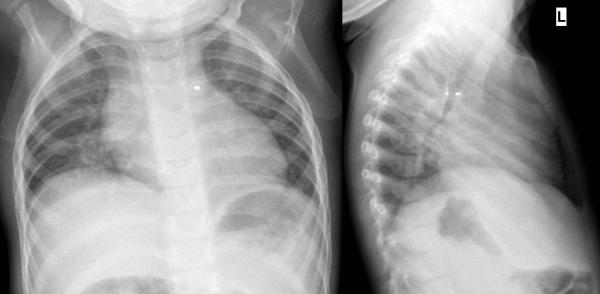 institut für diagnostische interventionelle und pädiatrische radiologie ...