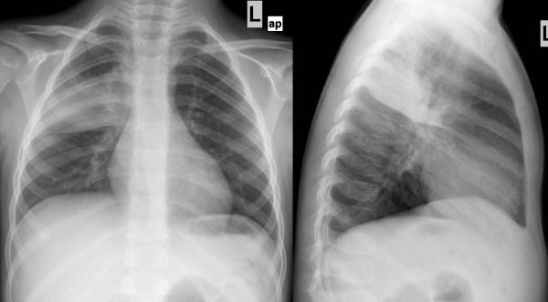 © Institut für Diagnostische, Interventionelle und Pädiatrische ...