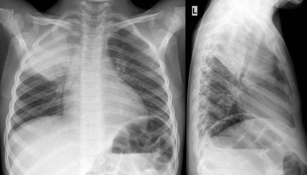 institut für diagnostische interventionelle und pädiatrische radiologie ...