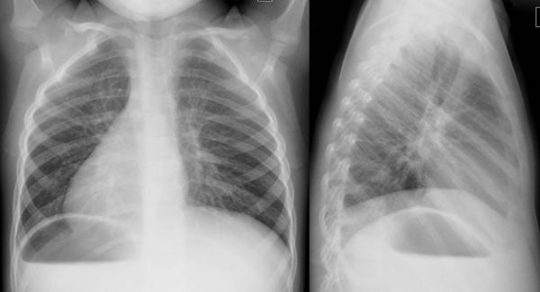 institut für diagnostische interventionelle und pädiatrische radiologie ...