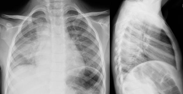 institut für diagnostische interventionelle und pädiatrische radiologie ...