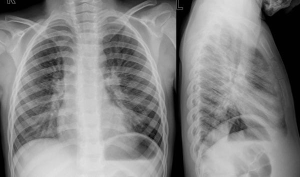 institut für diagnostische interventionelle und pädiatrische radiologie ...