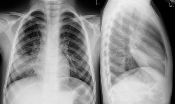 institut für diagnostische interventionelle und pädiatrische radiologie ...