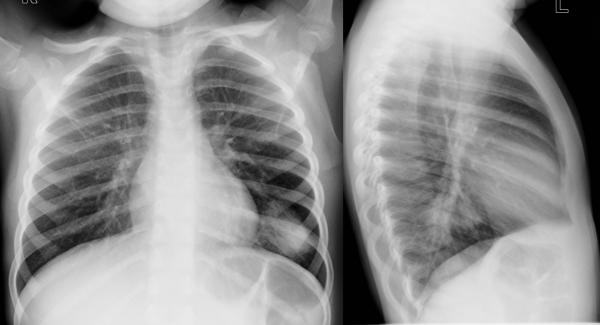 institut für diagnostische interventionelle und pädiatrische radiologie ...