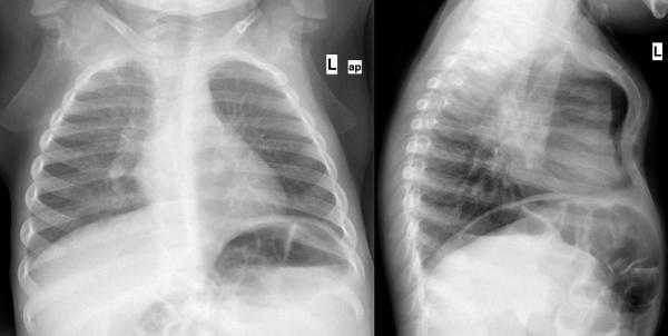 institut für diagnostische interventionelle und pädiatrische radiologie ...