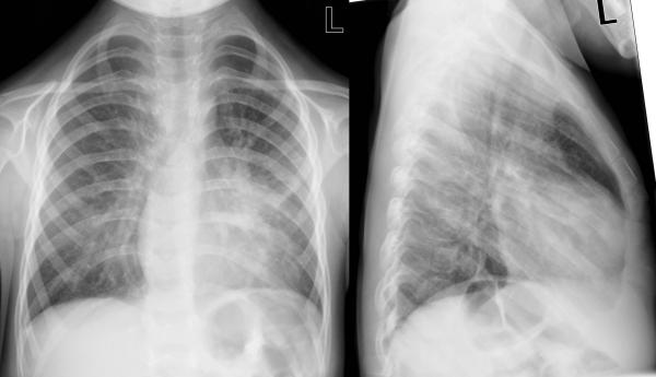 institut für diagnostische interventionelle und pädiatrische radiologie ...