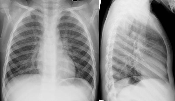 institut für diagnostische interventionelle und pädiatrische radiologie ...