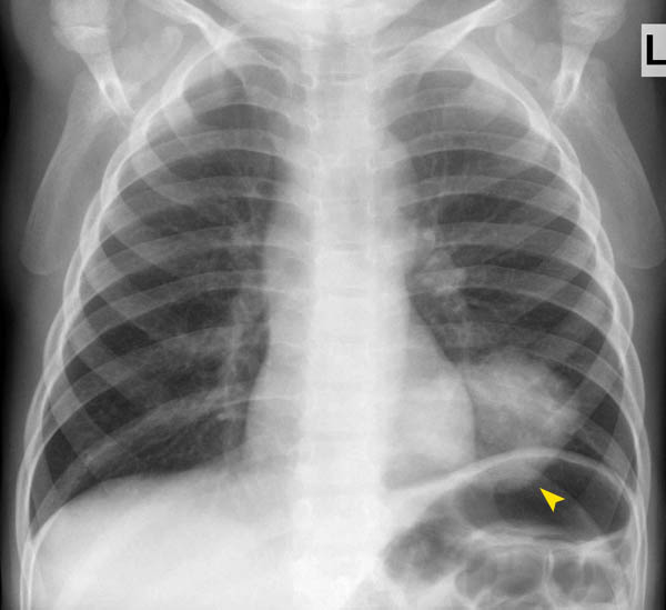 © Institut für Diagnostische, Interventionelle und Pädiatrische ...