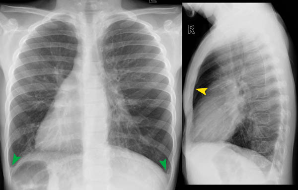 © Institut für Diagnostische, Interventionelle und Pädiatrische ...