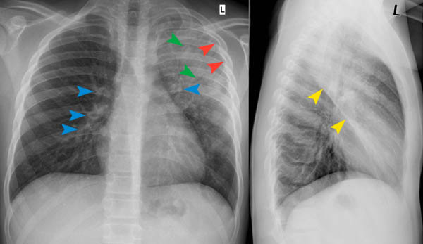 © Institut für Diagnostische, Interventionelle und Pädiatrische ...