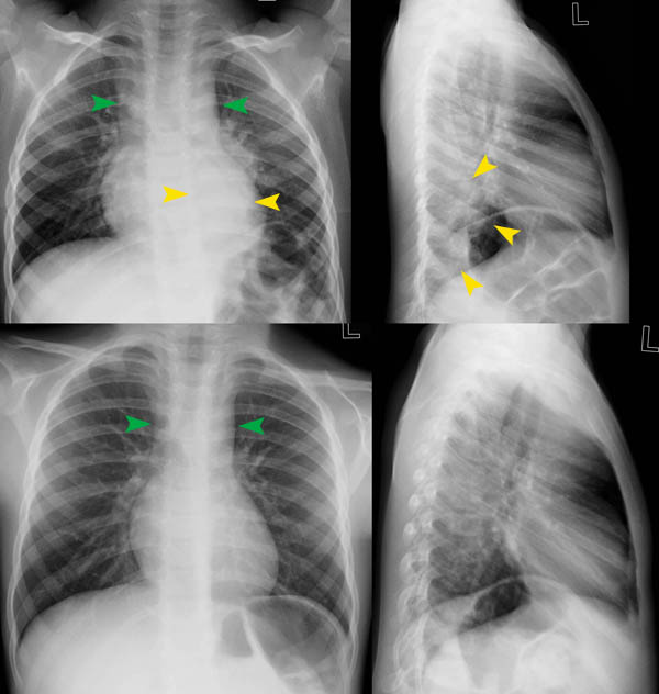 © Institut für Diagnostische, Interventionelle und Pädiatrische ...